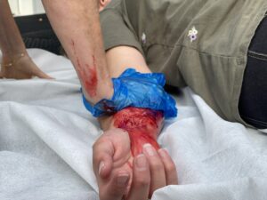 formation psc premiers secours citoyen hemorragie scaled 1.jpg